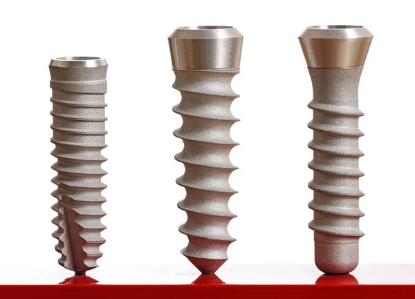 dental implants