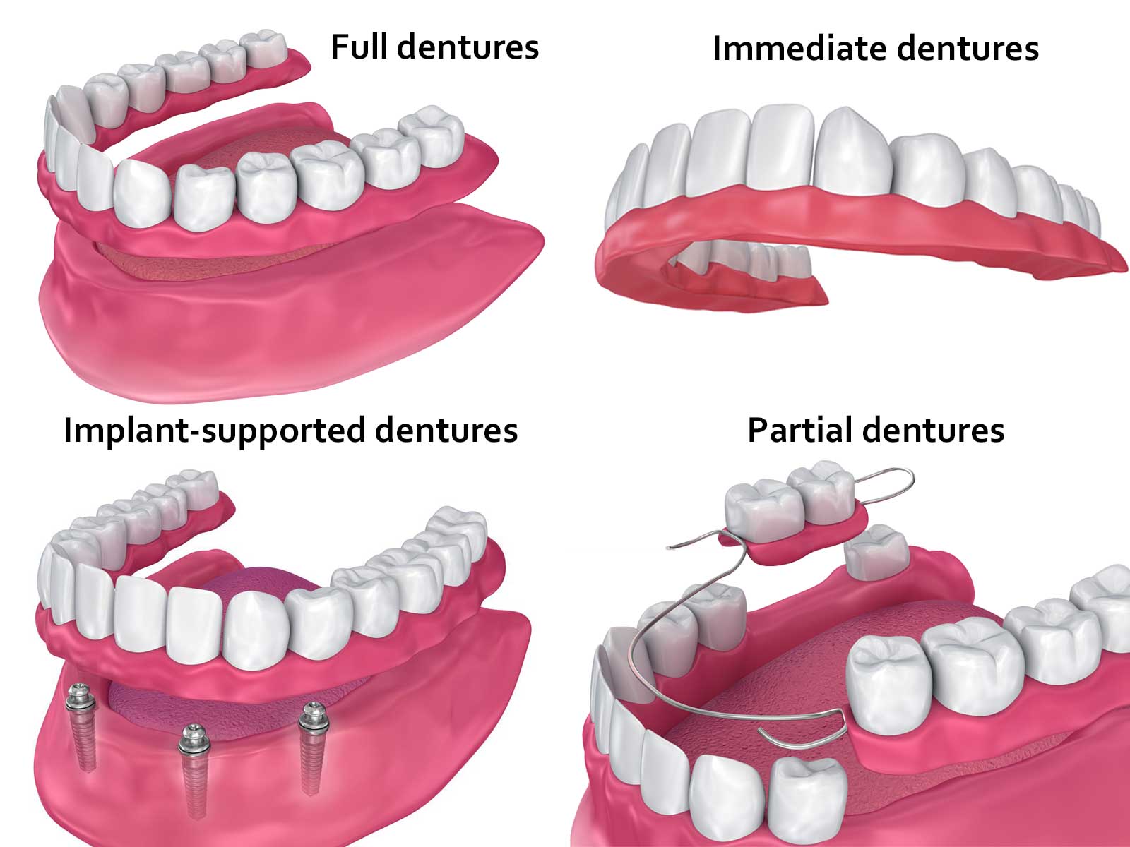 types of dentures